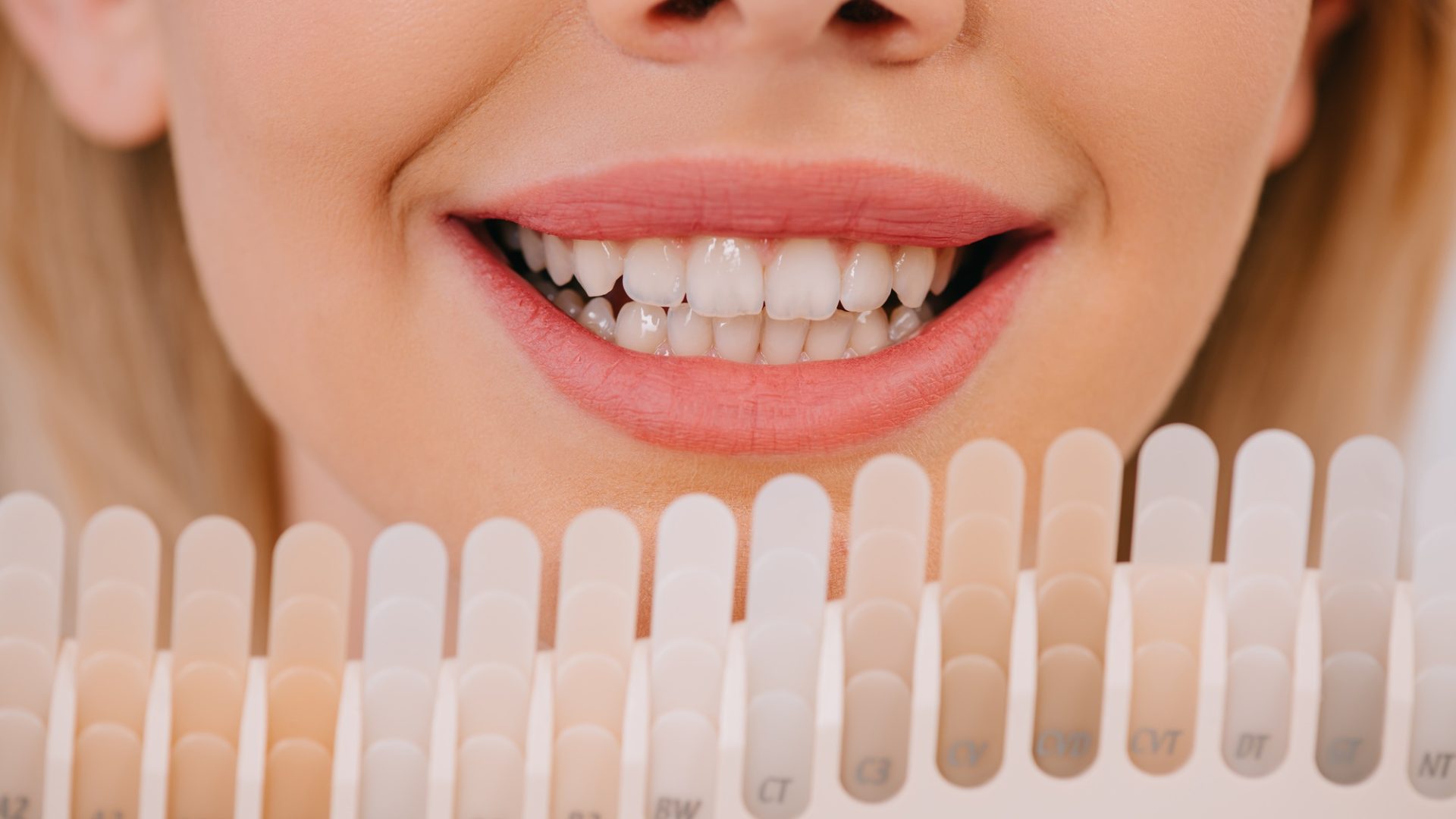 cropped view of smiling woman holding teeth color palette, teeth whitening concept